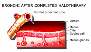 After Halotherapy